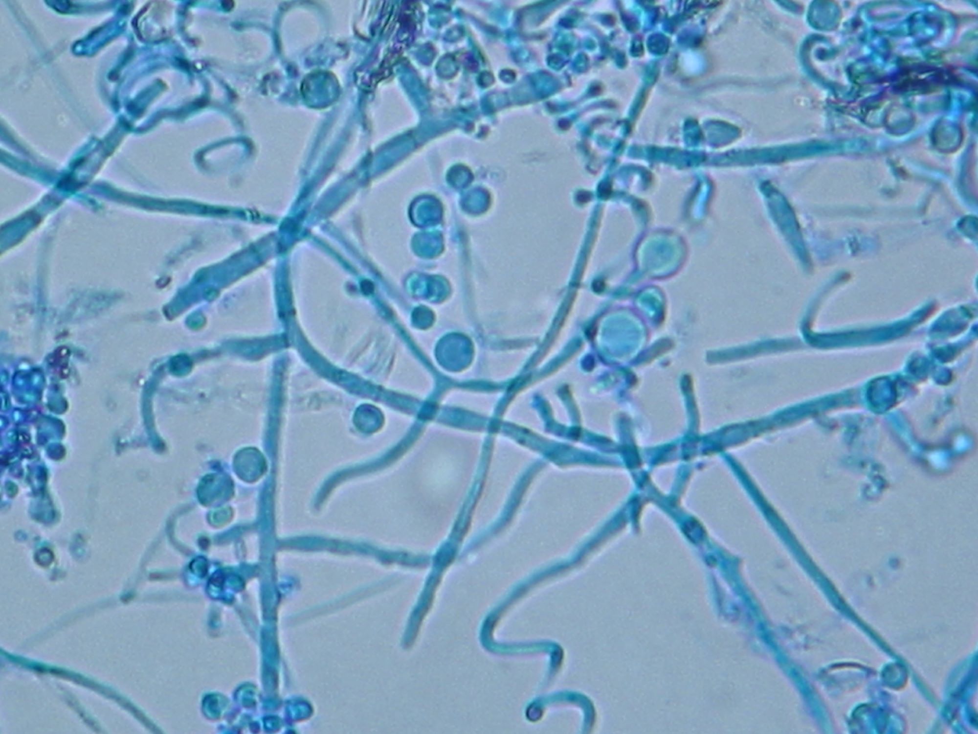LABOPART Trichophyton indotineae