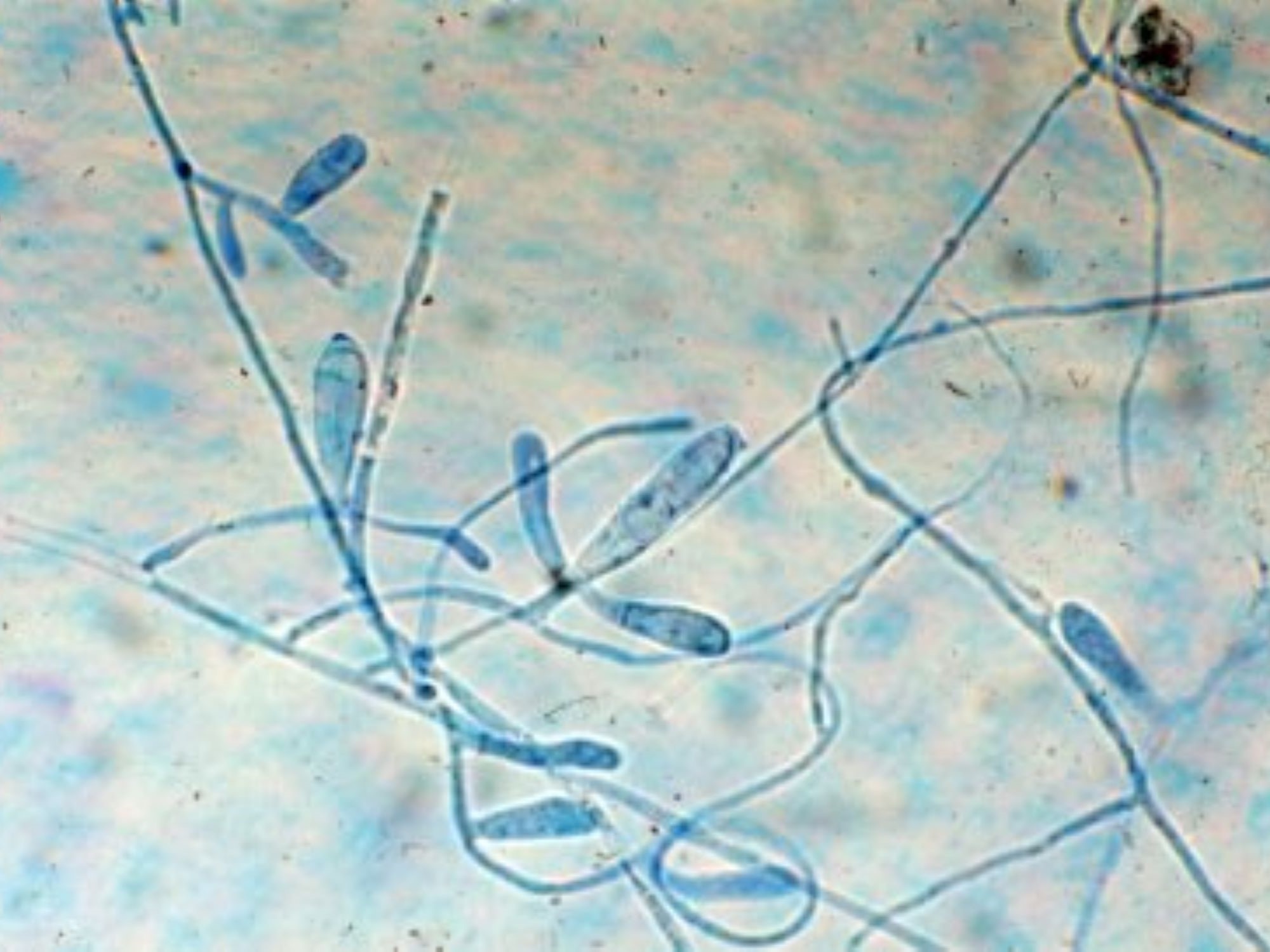 LABOPART Epidermophyton floccosum