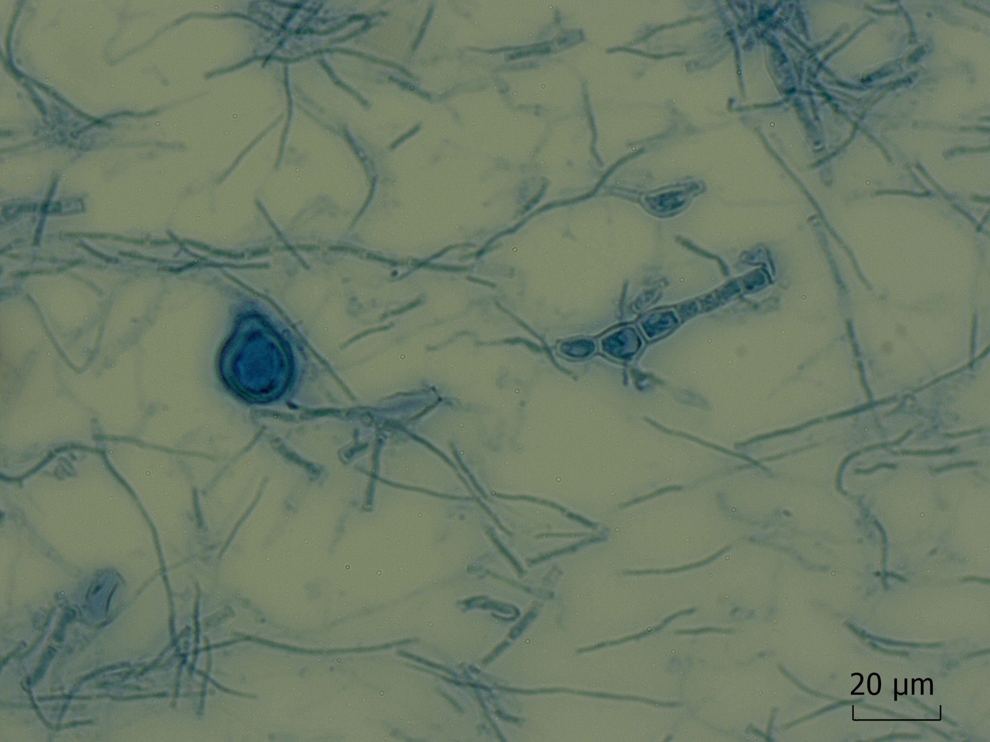 LABOPART Nannizzia perplicata